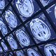 Illustration for article titled Autism starts affecting babies' brains as early as 4 months old